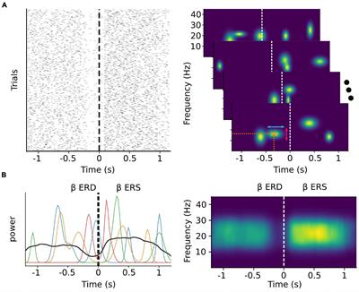 An Impending Paradigm Shift in Motor Imagery Based Brain-Computer Interfaces